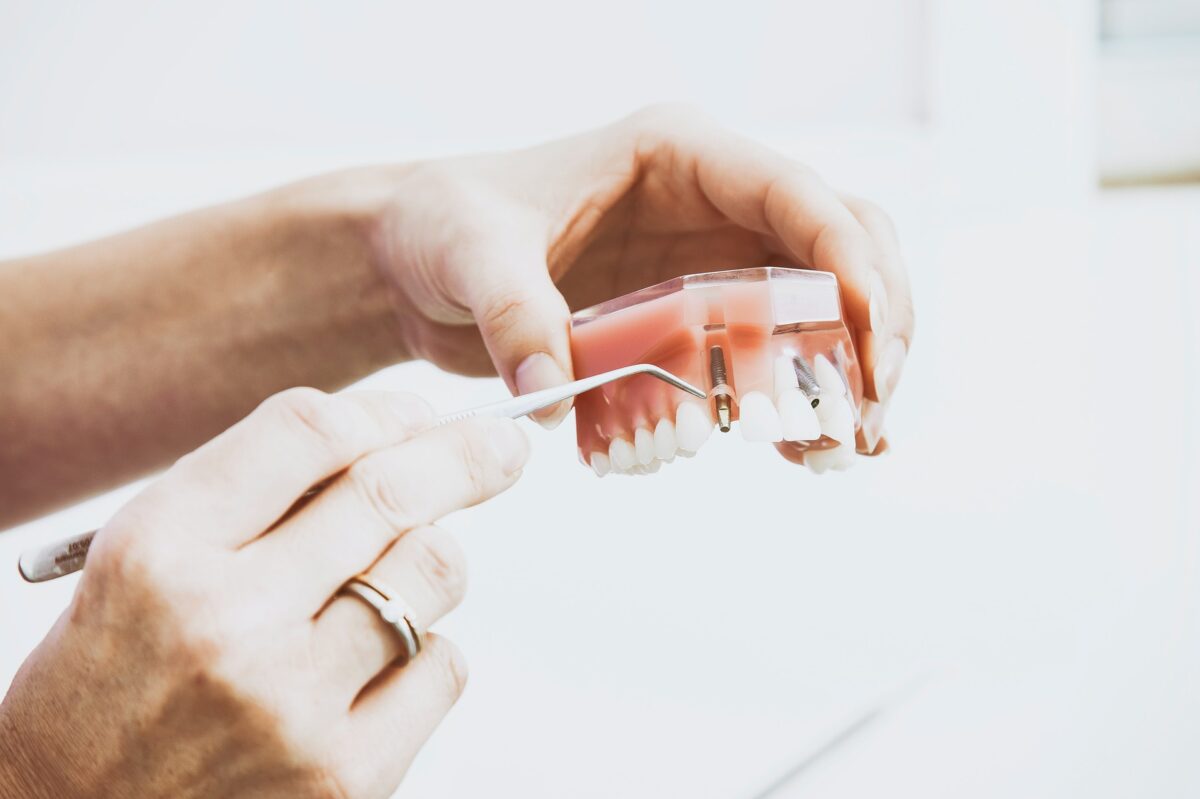 Comment bien coller sa prothèse dentaire ? – Massage / L'AyurVeda / huile  Essentielle / Aromathérapie /
